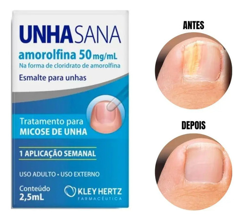 Unha Sana Esmalte Antimicótico 50mg/ml (kit 2x2,5ml=5ml) Sem Cor
