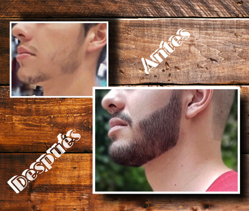 Tónico Para El Crecimiento De Barba Minoxidil