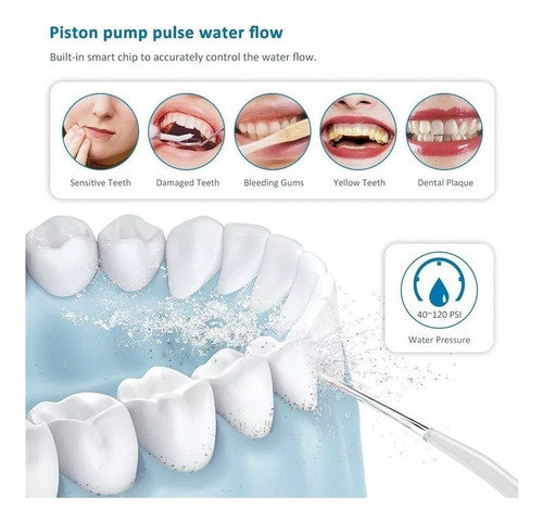 Irrigador Dentário Ultra Oral Portátil Waterflosser 310ml