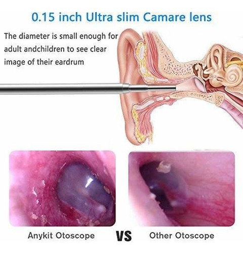 Endoscope Camara Usb Otoscope Mm Small Lens Hd Mega Pixel