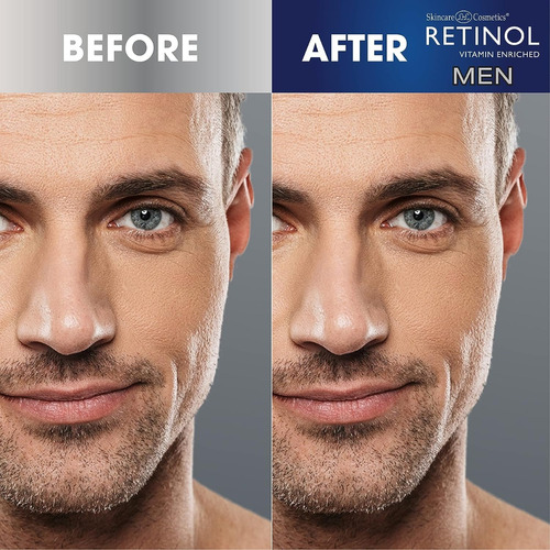 Retinol - Crema De Ojos Para Hombre Minimizar Signos Envejec