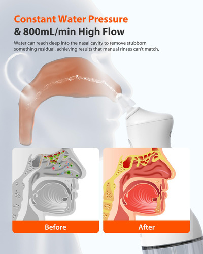 Sistema De Irrigación Nasal Ihealth Neti Pot Pro 400 Ml Con