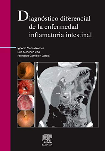 Libro Diagnóstico Diferencial De La Enfermedad Inflamatoria