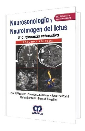 Neurosonología Y Neuroimagen Del Ictus 2 Ed.