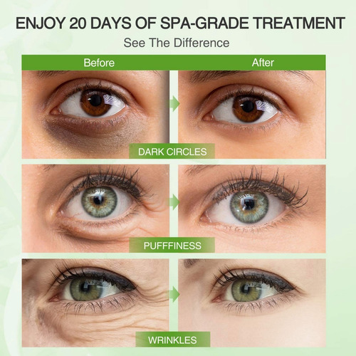 Imagen 7 de 10 de Parches Hidratante Hydrogel Aminoacidos Elimina Ojeras 60pcs