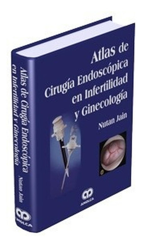 Atlas De Cirugía Endoscópica En Infertilidad Y Ginecología