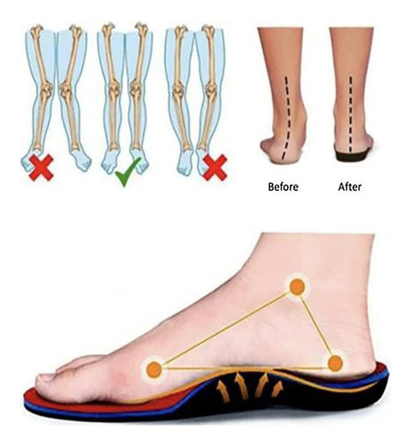 Zapatillas De Deporte Sin Cordones Con Colchón De Aire Para