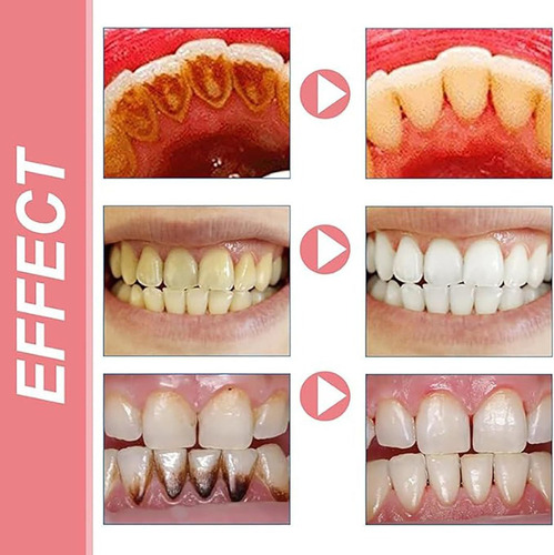 Pasta Dental Probiótica Fj Sp-8 Para El Mal Aliento, 1 Unida