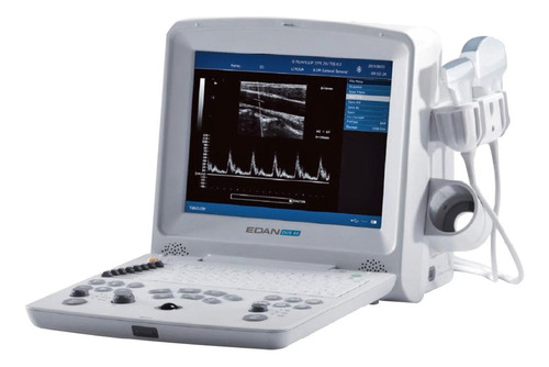 Ecografo B/n Edan Dus60 Portatil Con Doppler Veterinario