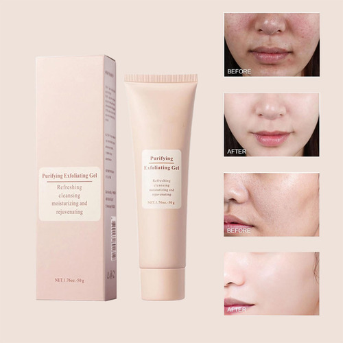 Gel Exfoliante 50 G Y Limpiador Facial De Queratina Para Pie