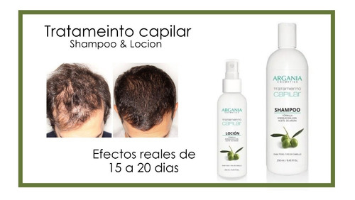 Tratamiento Capilar