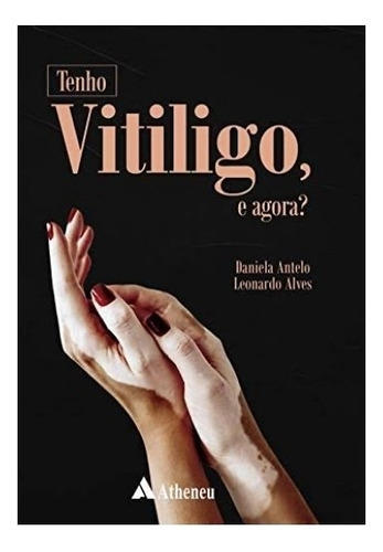 Tenho Vitiligo, E Agora