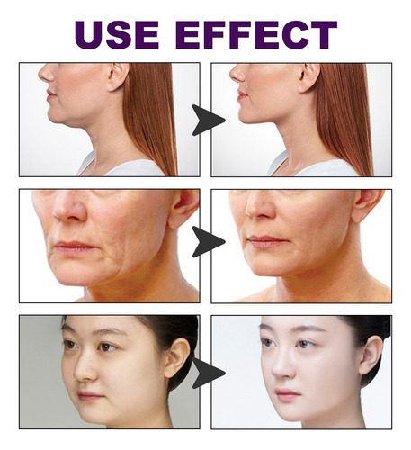 & Parche De Estiramiento Facial K For Modelar La Cara Y