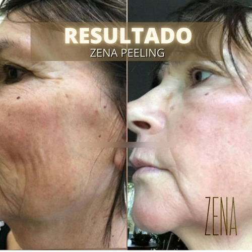 Peeling De Algas Naturais Zena 1 SachĂȘ
