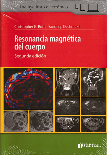 Resonancia Magnetica Del Cuerpo - 2º Ed. - Roth - Deshmukh