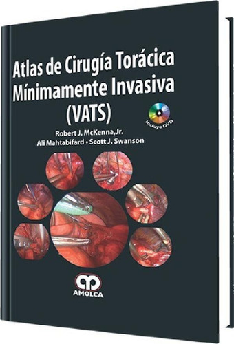 Libro - Atlas De Cirugía Torácica Mínimamente Invasiva Vats