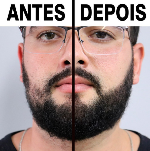 Imagem 4 de 9 de Escurecedor De Barba Preeche E Cobre Falhas + Shampoo