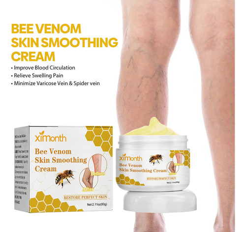 La Crema Reparadora De Venas De Abeja Alivia El Dolor E Hinc