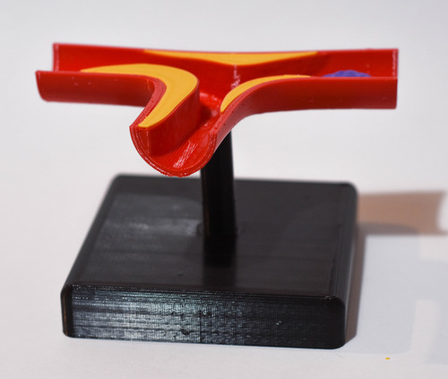 Maqueta Arteria Con Ateroma Semi Oclusivo - Medicina 3d