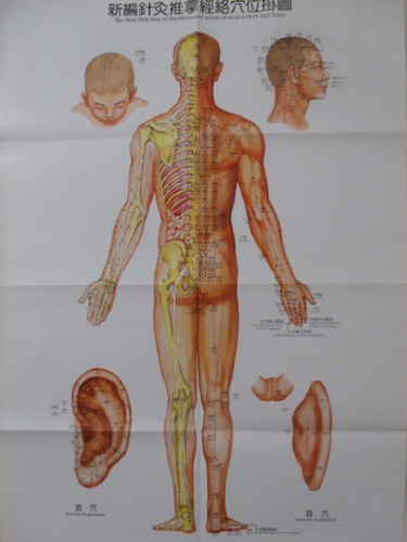 Set De 3 Afiches De Acupuntura