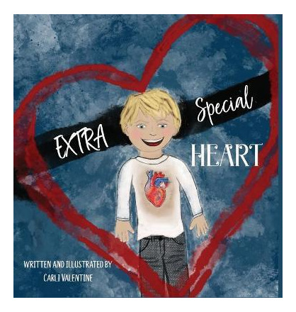 Libro Extra Special Heart : Highlighting The Beauty And S...