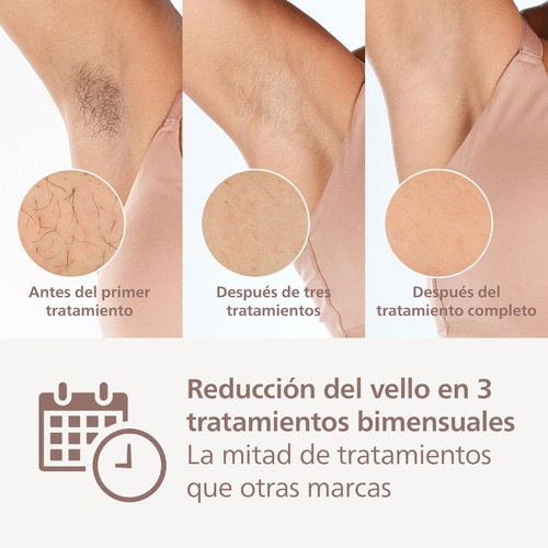 Philips Lumea Prestige Ipl Con Tecnología Sense Iq Morado