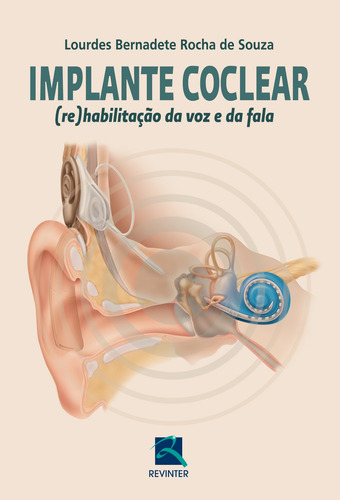 Implante Coclear, de Souza, Lourdes Bernadete Rocha de. Editora Thieme Revinter Publicações Ltda, capa mole em português, 2012