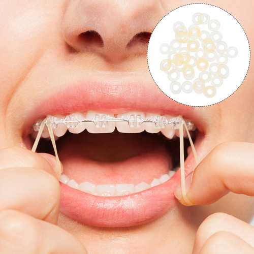 Ortodoncia Con Banda Elástica Dental, 500 Unidades