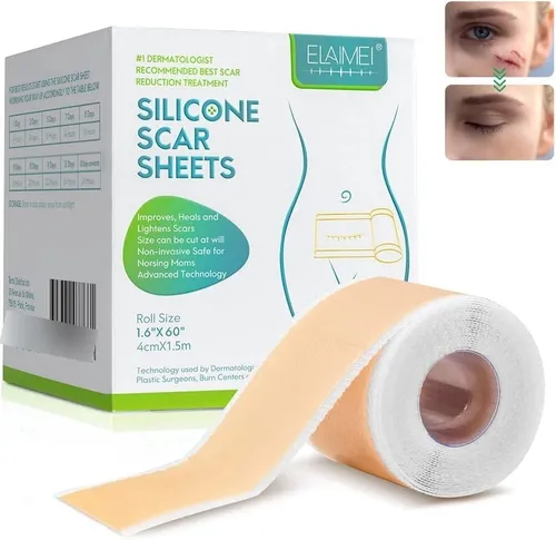 comprar Silicona Scar Sheets Parche De Silicona Para Cicatrices 1.5m