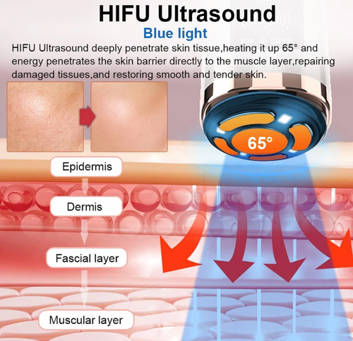Mini Hifu Rf Facial Corporal+ Microdermoabrasión Limpieza