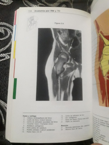 Libro Atlas Anatomia Por Tc Y Rm De J. Bloem Y D. Sartoris (Usado)