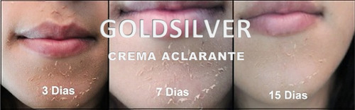 Crema Blanqueadora Permanente (monobenzona 50 Gr Al 40%)