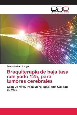 Libro Braquiterapia De Baja Tasa Con Yodo 125, Para Tumor...