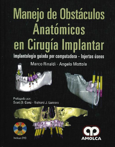 Libro Manejo De Obstáculos Anatómicos En Cirugía Implantar D