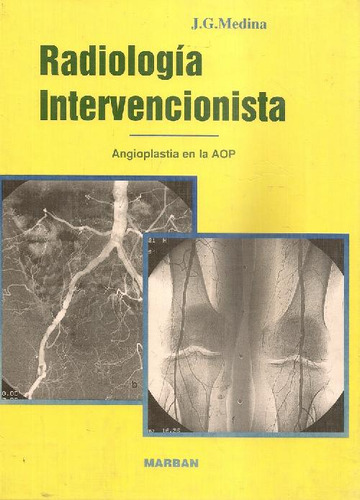 Libro Radiología Intervencionista: Angioplastia En La Arteri