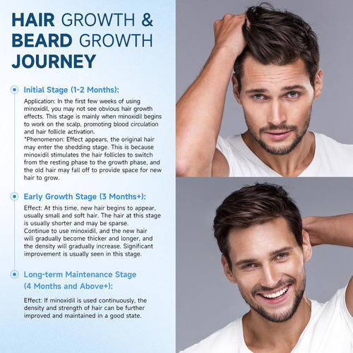 Minoxidil Spray Felicemy 5% Para El Crecimiento Del Cabello