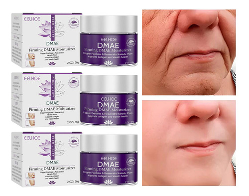 Creme Retinol Importado Remoção Enrugas Anti-idade Firmado