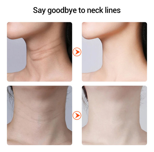 Medidor De Belleza Microcorriente Lifting Y Reducción De