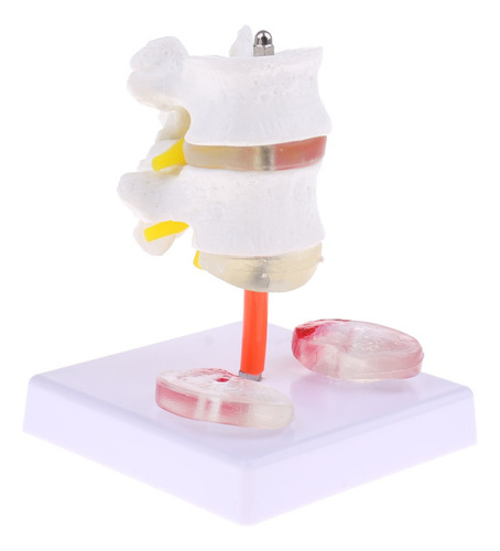 Vértebra Lombar Da Coluna Vertebral Humana 1: 1 Com Modelo