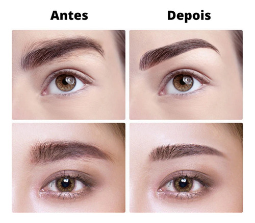 Kit Depilador De Pelos Laser Corporal E Caneta Sobrancelha
