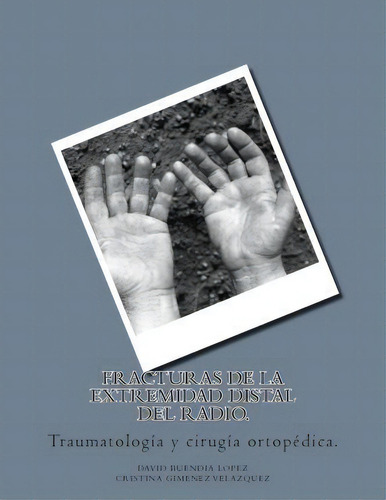 Fracturas De La Extremidad Distal Del Radio., De D David Buendia Lopez. Editorial Createspace Independent Publishing Platform, Tapa Blanda En Español