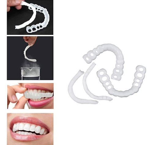 Dentaduras Postizas Instantáneas,carillas Dentales,carillas