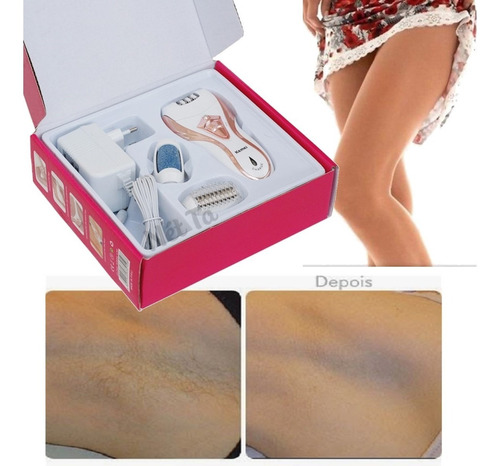 Imagem 6 de 7 de Aparador De Pelos Eletrico Feminino P/ Pernas Biquini Buço