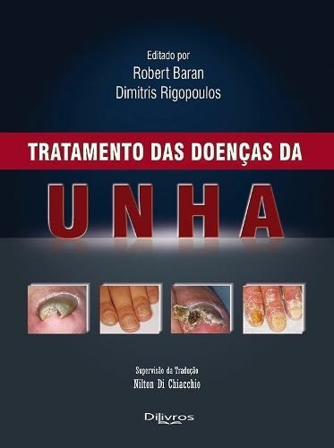Tratamento Das Doenças Da Unha, De Baran, Roberto / Rigopoulos, Dimitris. Editora Dilivros, Capa Dura, Edição 1 Em Português, 2014