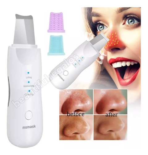 Espátula Facial Ultrasónica Peeling Skin Scrubber Recargable