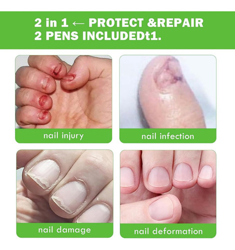 Prevención De Morderse Las Uñas - Fórmula Vegetal