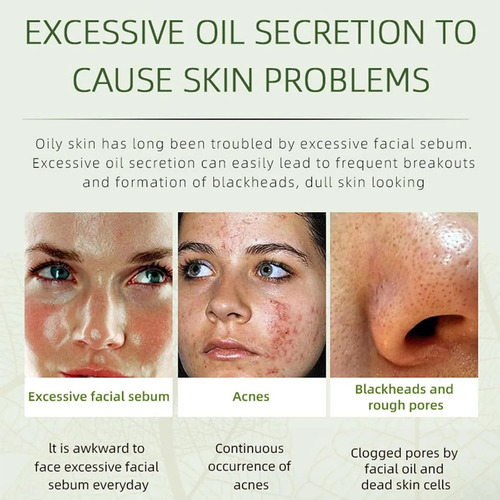 Natural Eliminating Facial//creme Hidratante!
