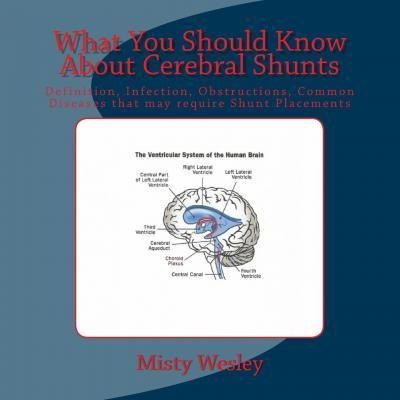 What You Should Know About Cerebral Shunts - Misty Lynn W...