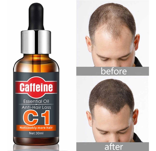 Aceite Esencial Cafeina C1 Crecimiento Cabello Caida 30ml