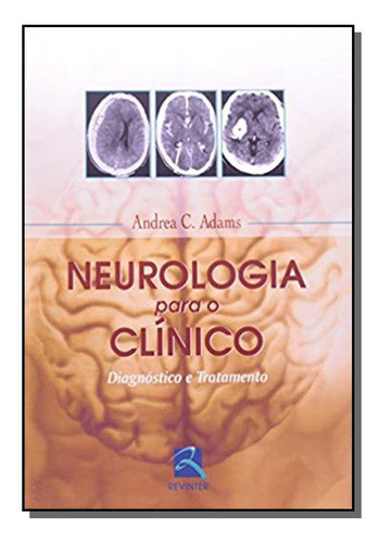 Neurologia Para O Clinico: Diagnostico E Tratamento, De Andrea C. Adams. Editora Revinter Em Português